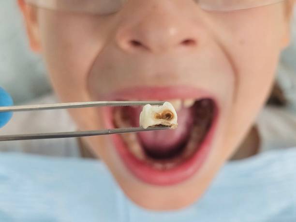 Best Dentist for Severe Toothache  in Kulpmont, PA